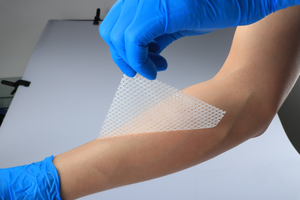 Strato di contatto in silicone personalizzato per la pelle chirurgica